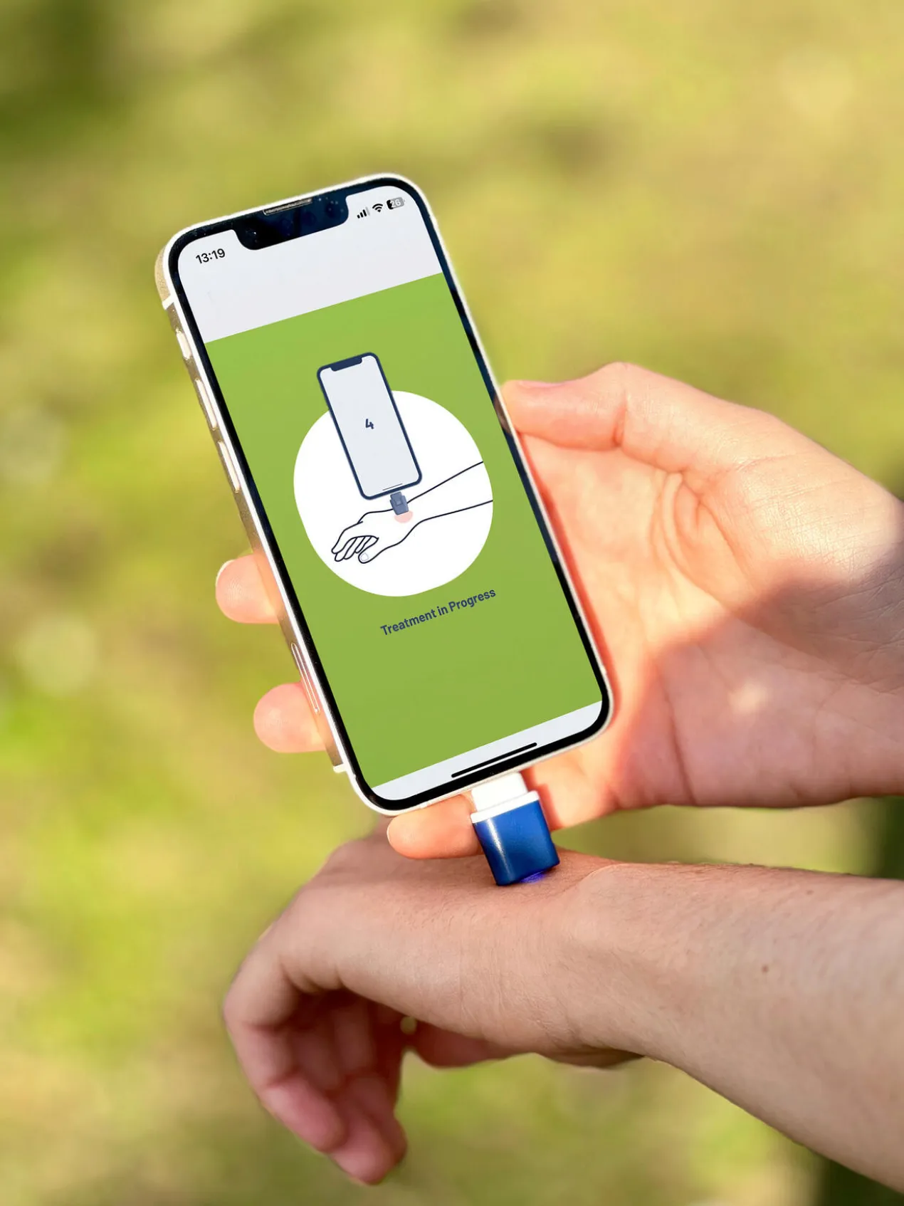 Smartphone-Insektenstichheiler